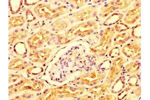 IHC image of ABIN7156316 diluted at 1:300 and staining in paraffin-embedded human kidney tissue performed on a Leica BondTM system. (OCRL 抗体  (AA 121-271))
