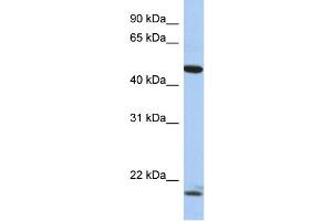WB Suggested Anti-PLAGL1 Antibody Titration:  0.