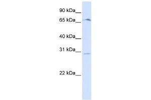 OR6C75 antibody used at 1 ug/ml to detect target protein. (OR6C75 抗体  (Middle Region))