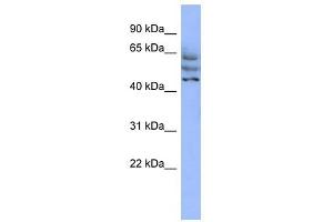 C3ORF19 antibody used at 1 ug/ml to detect target protein. (CCDC174 抗体  (Middle Region))