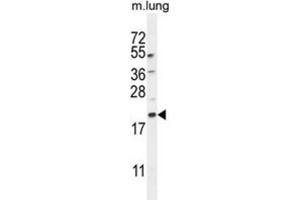 Western Blotting (WB) image for anti-APG8a,b antibody (ABIN2995751) (APG8a,b 抗体)