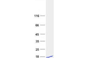 ACBD7 Protein (Myc-DYKDDDDK Tag)