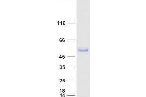 Western Blotting (WB) image for Tripartite Motif Containing 15 (TRIM15) protein (Myc-DYKDDDDK Tag) (ABIN2734225)