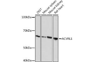 Western blot analysis of extracts of various cell lines, using  Rabbit mAb (ABIN7265412) at 1:1000 dilution. (ACVRL1 抗体)