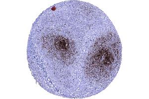 Immunohistochemistry (IHC) image for anti-Fc Fragment of IgE, Low Affinity II, Receptor For (CD23) (FCER2) (AA 48-321) antibody (ABIN7477405)