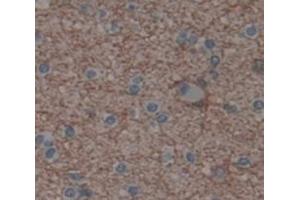 Used in DAB staining on fromalin fixed paraffin- embedded Kidney tissue (SCAND3 抗体  (AA 366-526))