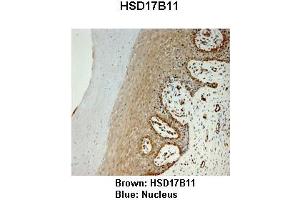 Sample Type :  Monkey vagina   Primary Antibody Dilution :   1:25   Secondary Antibody:  Anti-rabbit-HRP   Secondary Antibody Dilution:   1:1000   Color/Signal Descriptions:  Brown: HSD17B11 Blue: Nucleus   Gene Name:  HSD17B11   Submitted by:  Jonathan Bertin, Endoceutics Inc.