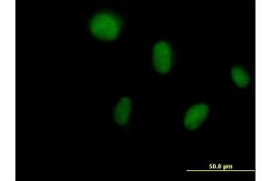 Immunofluorescence of purified MaxPab antibody to DCK on HeLa cell. (DCK 抗体  (AA 1-260))