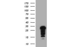 Image no. 1 for anti-Synovial Sarcoma, X Breakpoint 5 (SSX5) antibody (ABIN1501163) (SSX5 抗体)