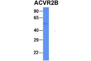 Host:  Rabbit  Target Name:  FAM46C  Sample Type:  Human Fetal Liver  Antibody Dilution:  1. (ACVR2B 抗体  (Middle Region))