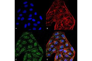 Immunocytochemistry/Immunofluorescence analysis using Mouse Anti-CD74 Monoclonal Antibody, Clone 6D9 . (CD74 抗体  (AA 1-100) (Atto 594))