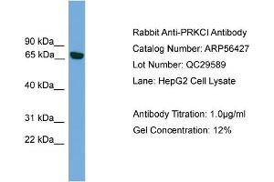 WB Suggested Anti-PRKCI  Antibody Titration: 0.