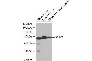 P2RY2 抗体