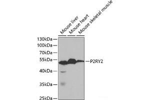 Western blot analysis of extracts of various cell lines using P2RY2 Polyclonal Antibody at dilution of 1:1000. (P2RY2 抗体)
