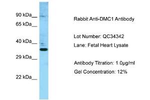 Host: Rabbit Target Name: DMC1 Sample Type: Fetal Heart Antibody Dilution: 1. (DMC1 抗体  (N-Term))