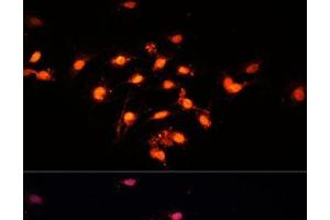 Immunofluorescence analysis of C6 cells using GTF3C4 Polyclonal Antibody at dilution of 1:100 (40x lens). (GTF3C4 抗体)