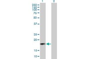 Western Blot analysis of IFNA6 expression in transfected 293T cell line by IFNA6 MaxPab polyclonal antibody. (IFNA6 抗体  (AA 1-189))