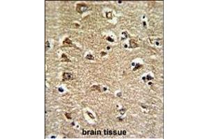 Immunohistochemistry (Paraffin-embedded Sections) (IHC (p)) image for anti-RAN, Member RAS Oncogene Family (RAN) (AA 12-39), (N-Term) antibody (ABIN390647)