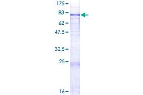 PIGT Protein (AA 1-578) (GST tag)