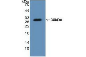 Detection of Recombinant KARS, Human using Polyclonal Antibody to Lysyl tRNA Synthetase (KARS) (KARS 抗体  (AA 323-553))