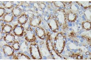 Immunohistochemistry of paraffin-embedded Mouse kidney using NDUFAB1 Polyclonal Antibody at dilution of 1:100 (40x lens). (NDUFAB1 抗体)