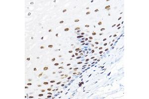 Immunohistochemistry of paraffin-embedded human esophageal using GTF2B Rabbit pAb (ABIN7267370) at dilution of 1:100 (40x lens). (GTF2B 抗体  (AA 50-150))