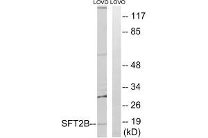Western blot analysis of extracts from LOVO cells, using SFT2B antibody. (Vesicle Transport Protein SFT2B (SFT2B) (Internal Region) 抗体)