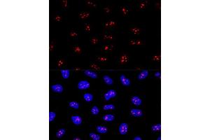 Confocal immunofluorescence analysis of U2OS cells using EBNBP2 Polyclonal Antibody (ABIN6132193, ABIN6139912, ABIN6139913 and ABIN6224909) at dilution of 1:200. (EBNA1BP2 抗体  (AA 1-306))