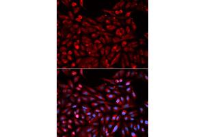 Immunofluorescence analysis of U2OS cells using NR1I3 antibody (ABIN5971021). (NR1I3 抗体)
