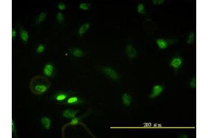 Immunofluorescence of monoclonal antibody to CBX5 on HeLa cell. (CBX5 抗体  (AA 1-191))