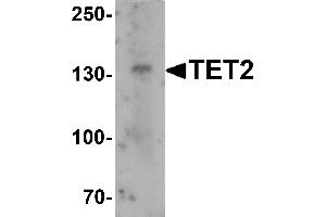 Western blot analysis of TET2 in SK-N-SH cell lysate with TET2 antibody at 1 µg/mL. (TET2 抗体  (N-Term))