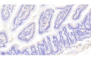 Immunohistochemistry (IHC) image for anti-Ubiquitin Carboxyl-terminal Esterase L1 (Ubiquitin Thiolesterase) (UCHL1) (AA 2-223) antibody (ABIN7440260)