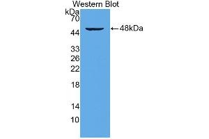 Western blot analysis of the recombinant protein. (CD28 抗体  (AA 33-174))