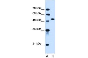 ACVR1 antibody used at 0. (ACVR1 抗体  (N-Term))
