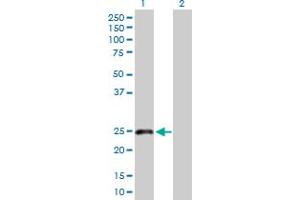 Western Blot analysis of CLEC1B expression in transfected 293T cell line by CLEC1B MaxPab polyclonal antibody. (C-Type Lectin Domain Family 1, Member B (CLEC1B) (AA 1-196) 抗体)