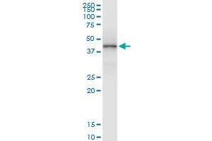 Immunoprecipitation (IP) image for anti-Major Histocompatibility Complex, Class I, A (HLA-A) (AA 1-365) antibody (ABIN516463)