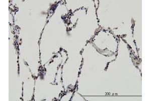 Image no. 3 for anti-Enhancer of Rudimentary Homolog (ERH) (AA 1-105) antibody (ABIN598672) (ERH 抗体  (AA 1-105))