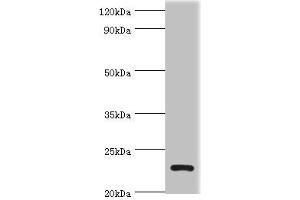 Western blot All lanes: APOBEC3C antibody at 3 μg/mL + K562 whole cell lysate Secondary Goat polyclonal to rabbit IgG at 1/10000 dilution Predicted band size: 23 kDa Observed band size: 23 kDa (APOBEC3C 抗体  (AA 1-190))