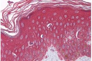 Human Skin: Formalin-Fixed, Paraffin-Embedded (FFPE) (FGFR1 抗体  (AA 179-195))