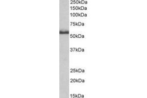 AP31402PU-N CD120b antibody staining of Rat Spinal Cord lysate at 0. (TNFRSF1B 抗体  (Internal Region))