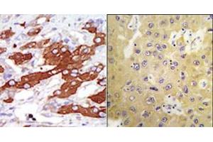 Image no. 2 for anti-serum/glucocorticoid Regulated Kinase Family, Member 3 (SGK3) (N-Term) antibody (ABIN360350)