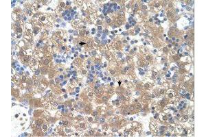 Image no. 1 for anti-Peroxisomal Biogenesis Factor 3 (PEX3) (AA 31-80) antibody (ABIN321040) (PEX3 抗体  (AA 31-80))