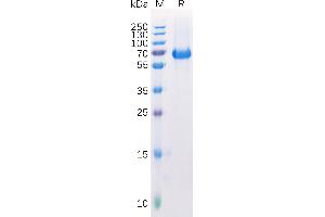 Human E Protein, His Tag on SDS-PAGE under reducing condition.