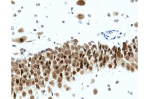 Immunohistochemistry: Rat hippocampus, formalin-fixed paraffin-embedded tissue, with citrate pre-treatment (20X magnification). (BDKRB2 抗体  (AA 350-364))