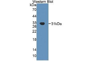 Western blot analysis of the recombinant protein. (AGRN 抗体  (AA 1329-1548))