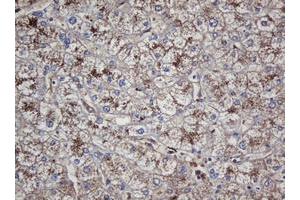Immunohistochemistry (IHC) image for anti-Crystallin, alpha A (CRYAA) antibody (ABIN1498754)