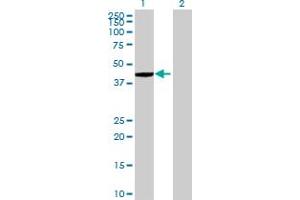 Western Blot analysis of ZNF707 expression in transfected 293T cell line by ZNF707 MaxPab polyclonal antibody. (ZNF707 抗体  (AA 1-369))