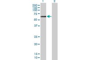 Western Blot analysis of GALNT14 expression in transfected 293T cell line by GALNT14 MaxPab polyclonal antibody. (GALNT14 抗体  (AA 1-552))