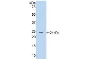 Detection of Recombinant CTSG, Rat using Polyclonal Antibody to Cathepsin G (CTSG) (Cathepsin G 抗体  (AA 51-250))
