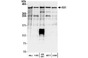 Western Blotting (WB) image for anti-RAP1 Interacting Factor Homolog (RIF1) (AA 1425-1450) antibody (ABIN7454645)